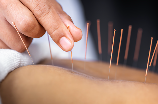 Fibromyalgia patient receiving chiropractic treatment in Mesa AZ for chronic pain relief