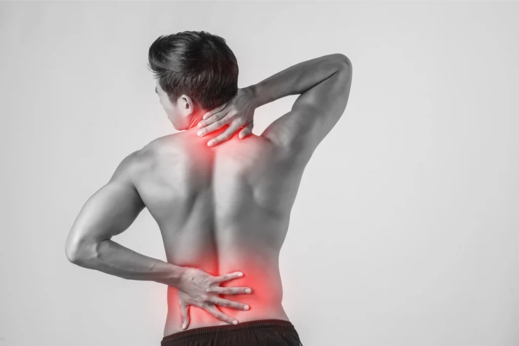 Side-view lumbar herniated disc irritating a nerve root
